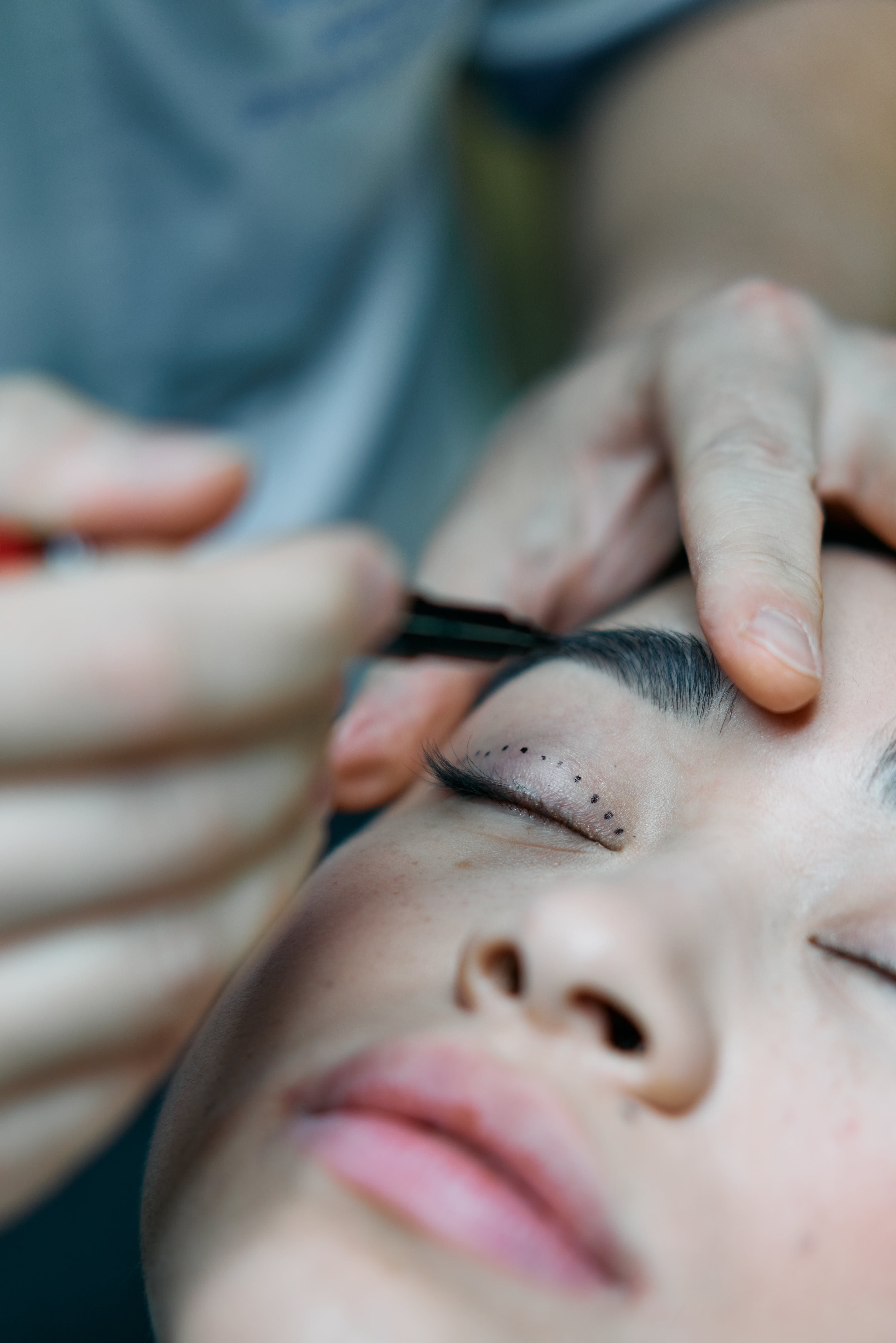 LASIK Eye Surgery